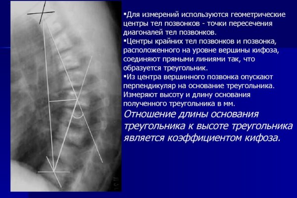 Kraken в россии